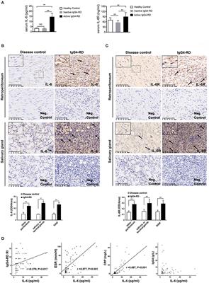 In vitro IL-6/IL-6R Trans-Signaling in Fibroblasts Releases Cytokines That May Be Linked to the Pathogenesis of IgG4-Related Disease